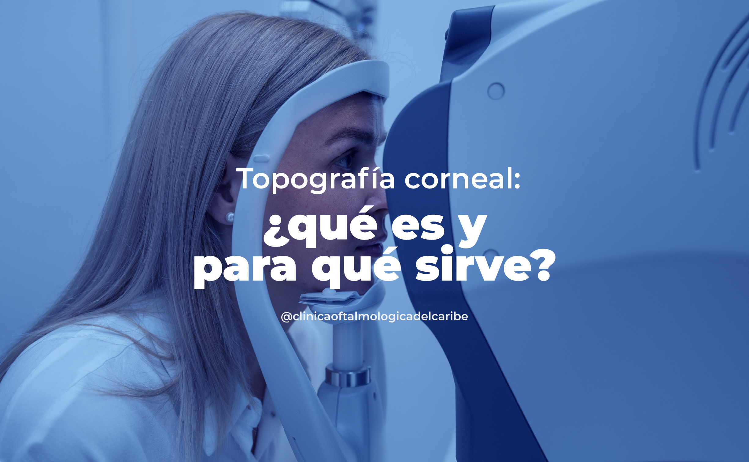 Topografía corneal en COFCA Barranquilla: examen no invasivo que crea mapa 3D de la córnea para detectar astigmatismo, queratocono, adaptar lentes de contacto y planear cirugía refractiva